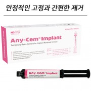 Any-Cem® 임플란트 시멘트